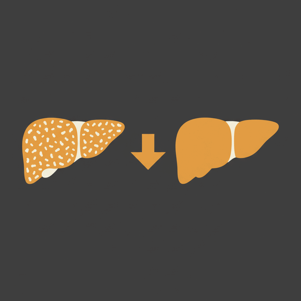 Retatrutide sharply reduces liver fat in clinical trials